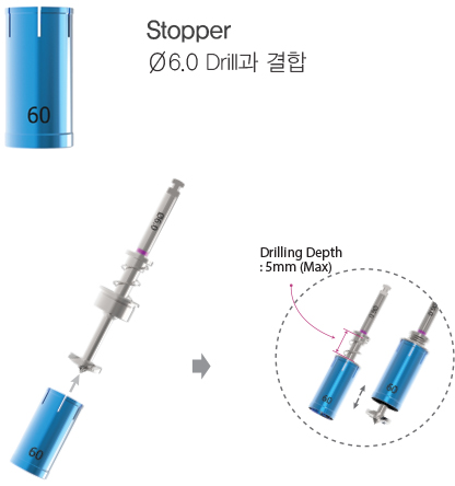 For Ø6.0 Drill