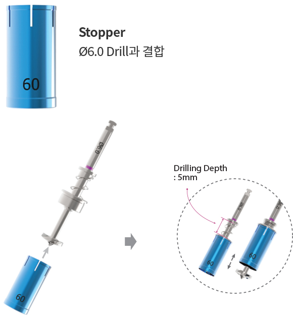 For Ø6.0 Drill
