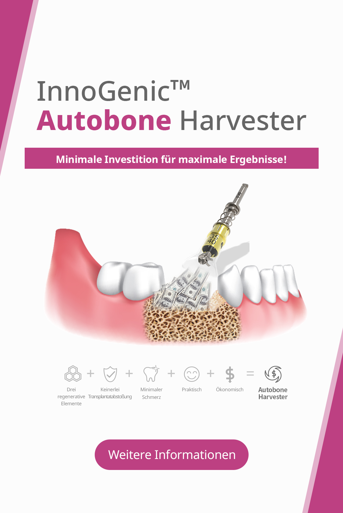 InnoGenic™ Autobone Harvester