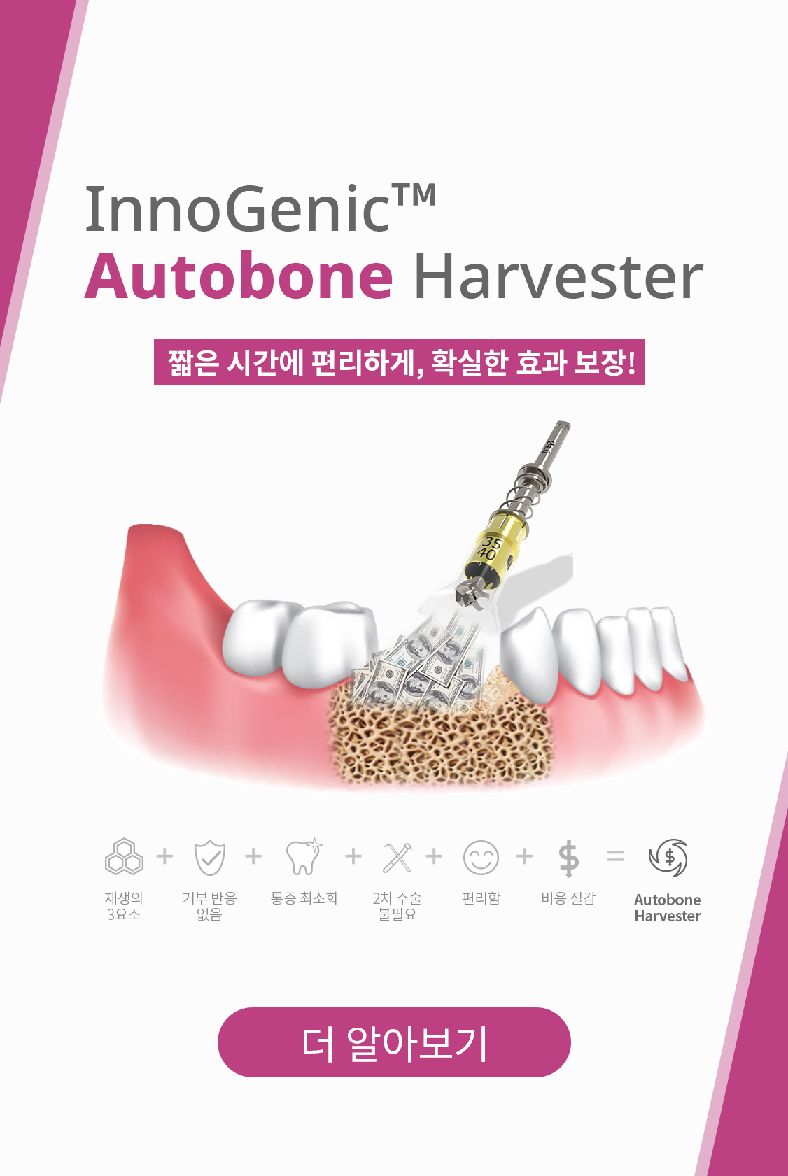 InnoGenic™ Autobone Harvester